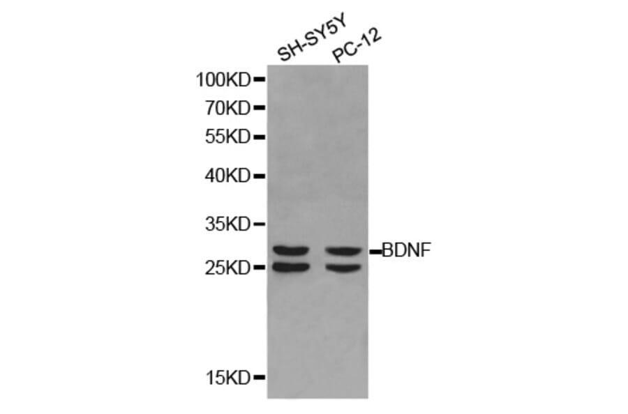 Western blot - BDNF Antibody from Signalway Antibody (32263) - Antibodies.com