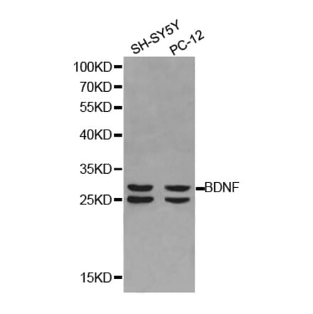 Western blot - BDNF Antibody from Signalway Antibody (32263) - Antibodies.com