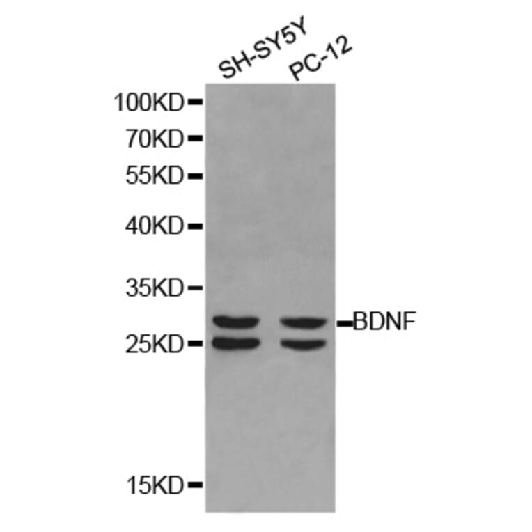 Western blot - BDNF Antibody from Signalway Antibody (32263) - Antibodies.com