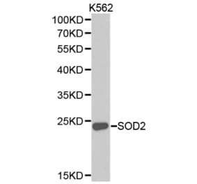 Western blot - SOD2 Antibody from Signalway Antibody (32265) - Antibodies.com