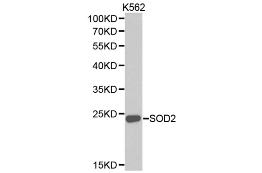 Western blot - SOD2 Antibody from Signalway Antibody (32265) - Antibodies.com