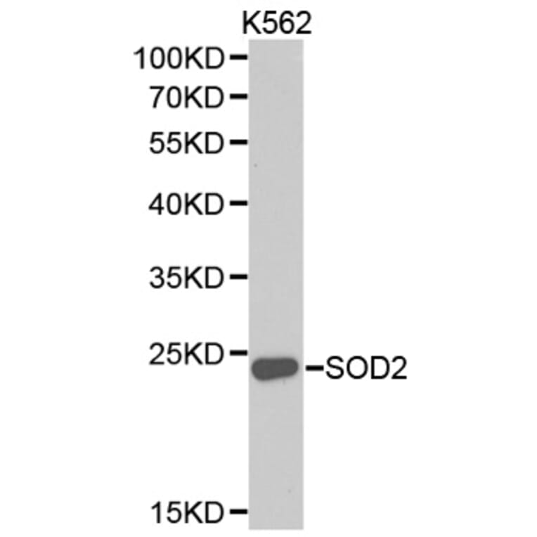 Western blot - SOD2 Antibody from Signalway Antibody (32265) - Antibodies.com