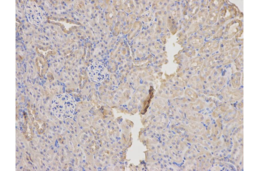 Immunohistochemistry - SOD2 Antibody from Signalway Antibody (32265) - Antibodies.com