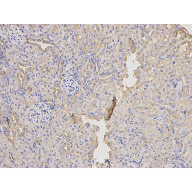 Immunohistochemistry - SOD2 Antibody from Signalway Antibody (32265) - Antibodies.com