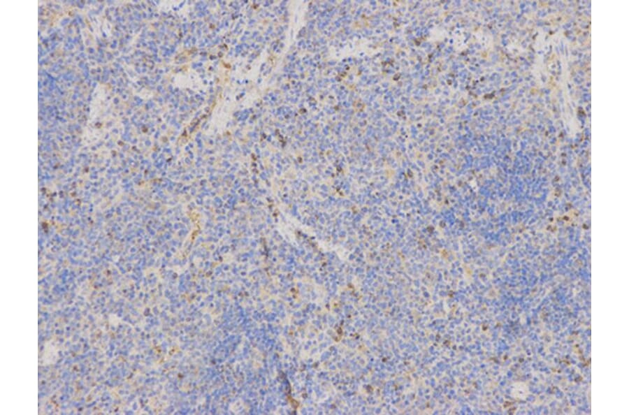 Immunohistochemistry - SOD2 Antibody from Signalway Antibody (32265) - Antibodies.com