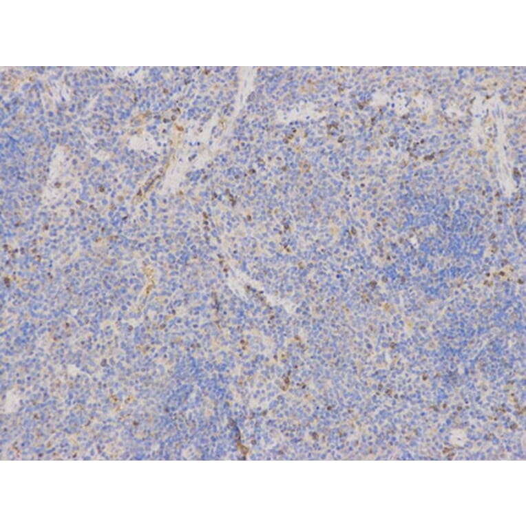 Immunohistochemistry - SOD2 Antibody from Signalway Antibody (32265) - Antibodies.com