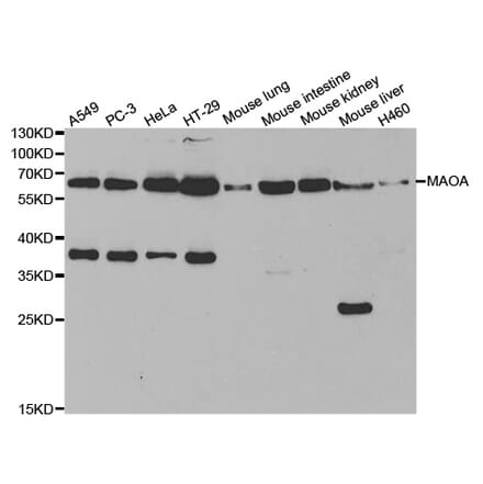 Western blot - MAOA Antibody from Signalway Antibody (32268) - Antibodies.com