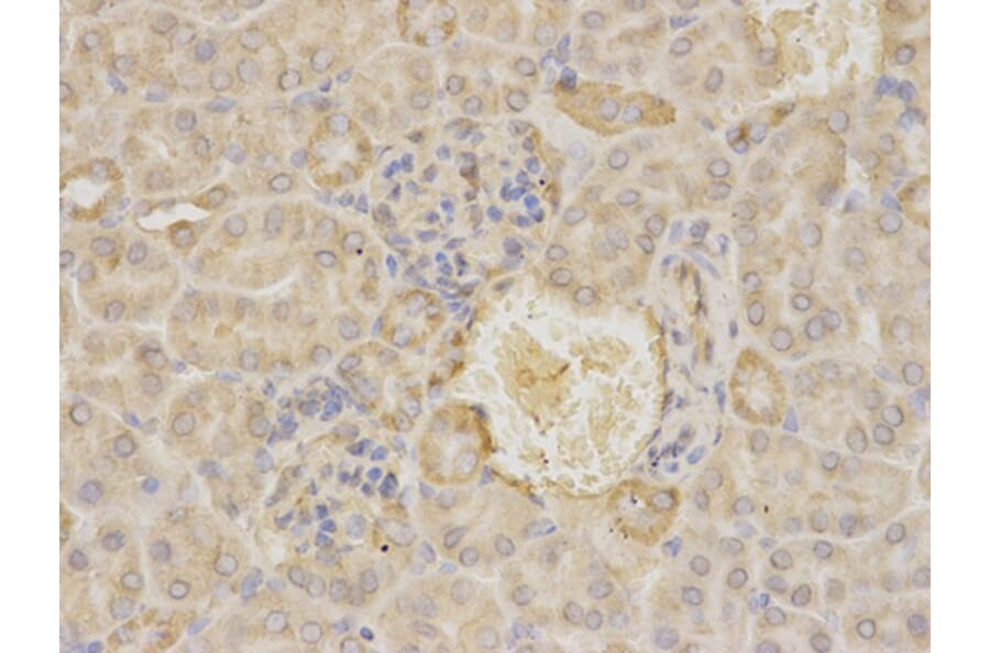 Immunohistochemistry - MAOA Antibody from Signalway Antibody (32268) - Antibodies.com