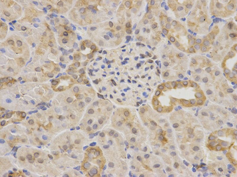 Anti-MAOA Antibody (A38428) | Antibodies.com