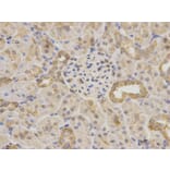 Immunohistochemistry - MAOA Antibody from Signalway Antibody (32268) - Antibodies.com