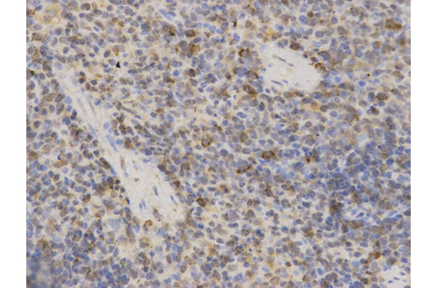 Immunohistochemistry - MAOA Antibody from Signalway Antibody (32268) - Antibodies.com