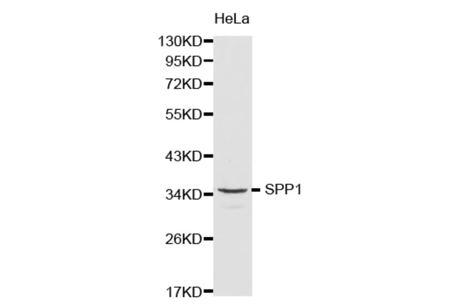Western blot - SPP1 Antibody from Signalway Antibody (32269) - Antibodies.com