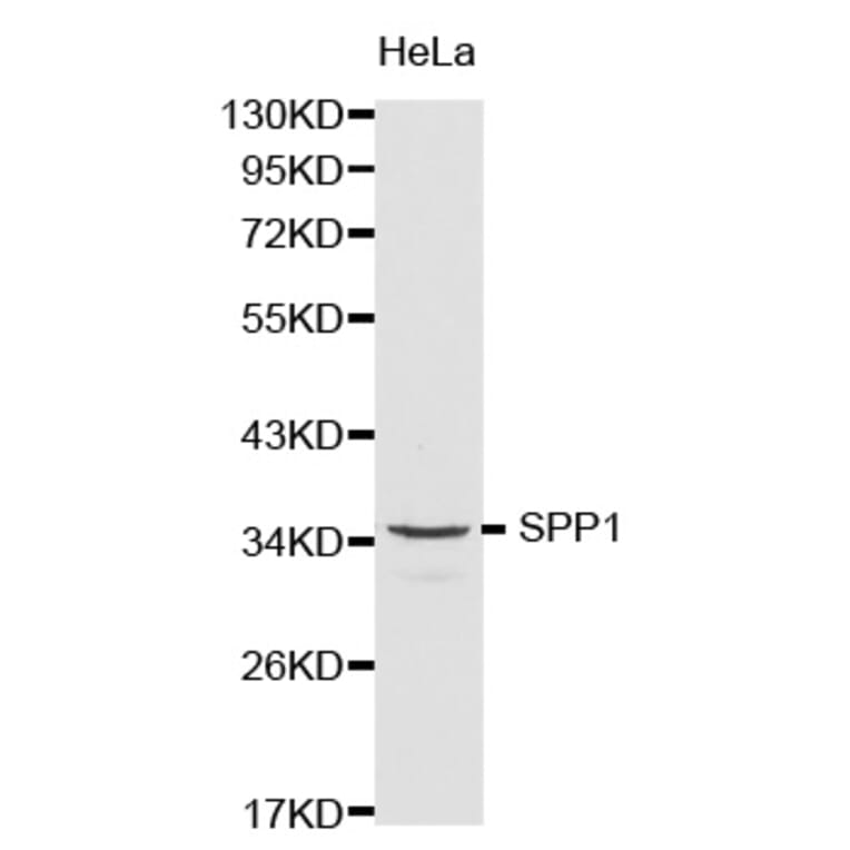 Western blot - SPP1 Antibody from Signalway Antibody (32269) - Antibodies.com