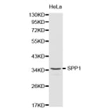 Western blot - SPP1 Antibody from Signalway Antibody (32269) - Antibodies.com