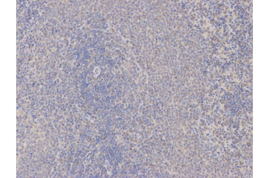 Immunohistochemistry - SPP1 Antibody from Signalway Antibody (32269) - Antibodies.com