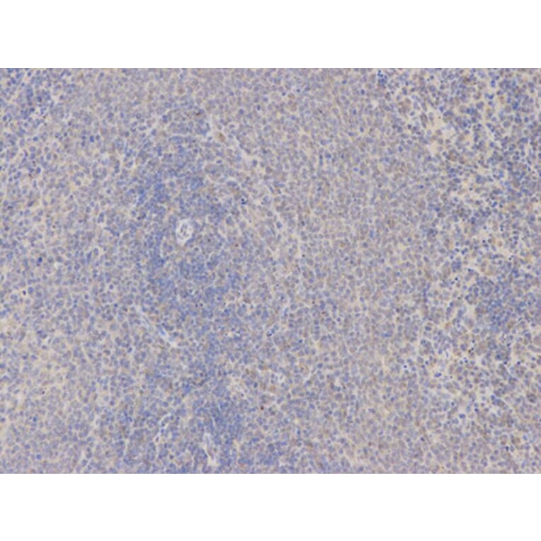 Immunohistochemistry - SPP1 Antibody from Signalway Antibody (32269) - Antibodies.com