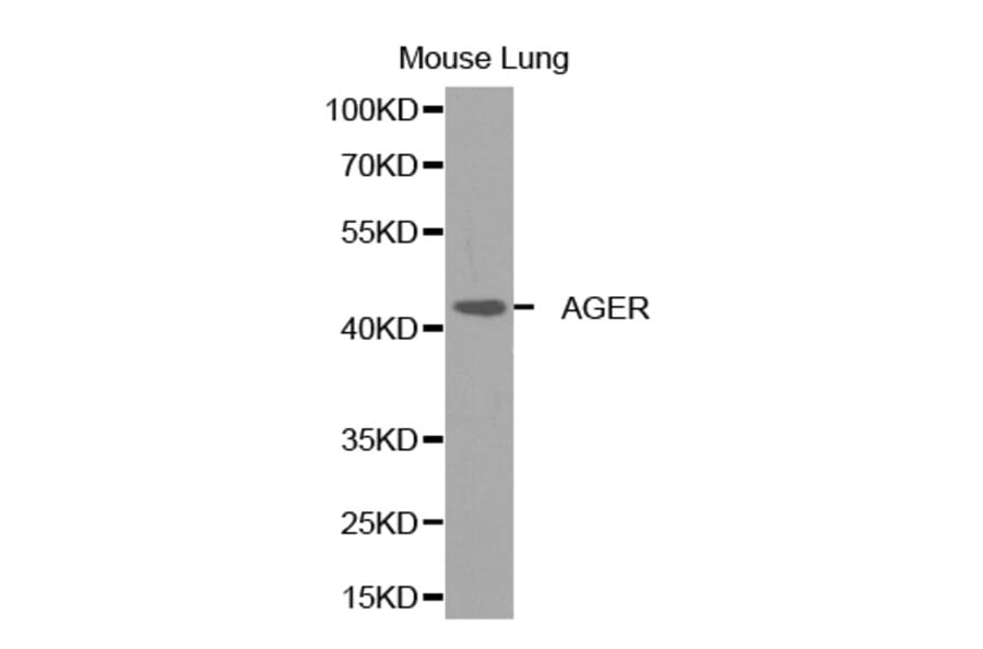 Western blot - AGER Antibody from Signalway Antibody (32272) - Antibodies.com
