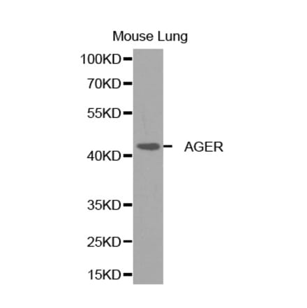 Western blot - AGER Antibody from Signalway Antibody (32272) - Antibodies.com