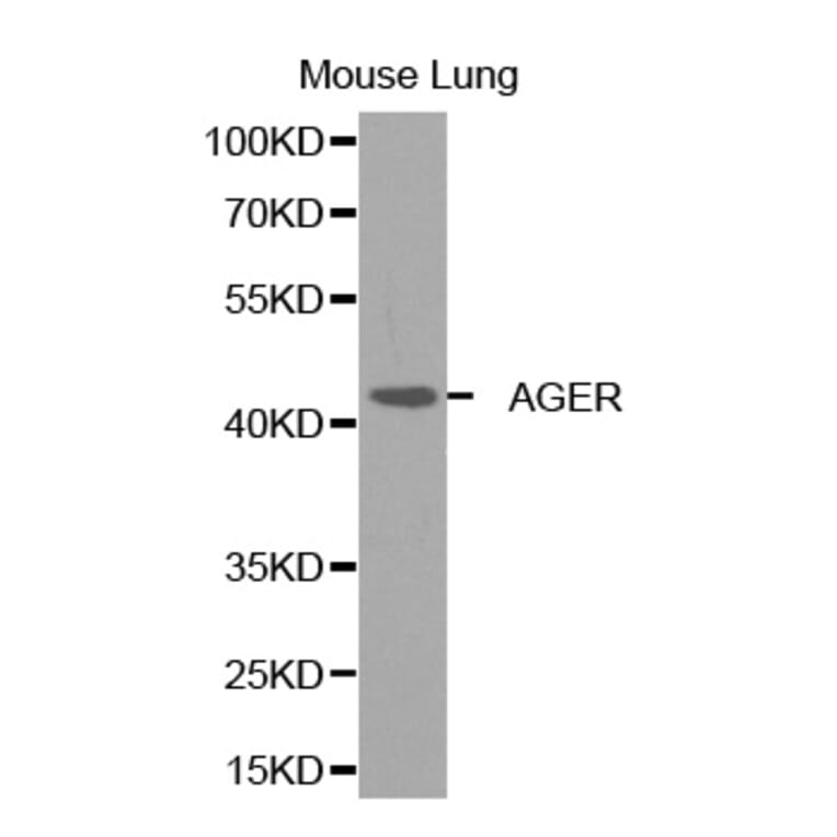 Western blot - AGER Antibody from Signalway Antibody (32272) - Antibodies.com
