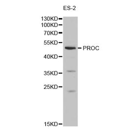 Western blot - PROC Antibody from Signalway Antibody (32278) - Antibodies.com