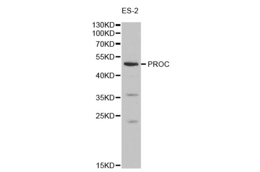 Western blot - PROC Antibody from Signalway Antibody (32278) - Antibodies.com