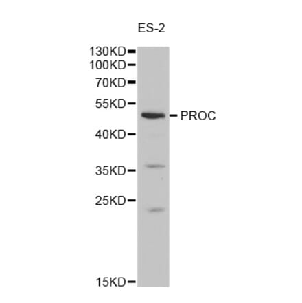 Western blot - PROC Antibody from Signalway Antibody (32278) - Antibodies.com