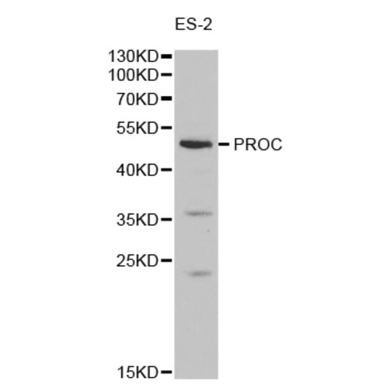 Western blot - PROC Antibody from Signalway Antibody (32278) - Antibodies.com