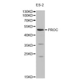 Western blot - PROC Antibody from Signalway Antibody (32278) - Antibodies.com