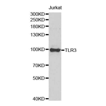 Western blot - TLR3 Antibody from Signalway Antibody (32281) - Antibodies.com