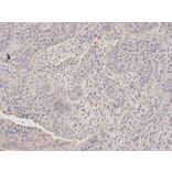 Immunohistochemistry - TLR3 Antibody from Signalway Antibody (32281) - Antibodies.com