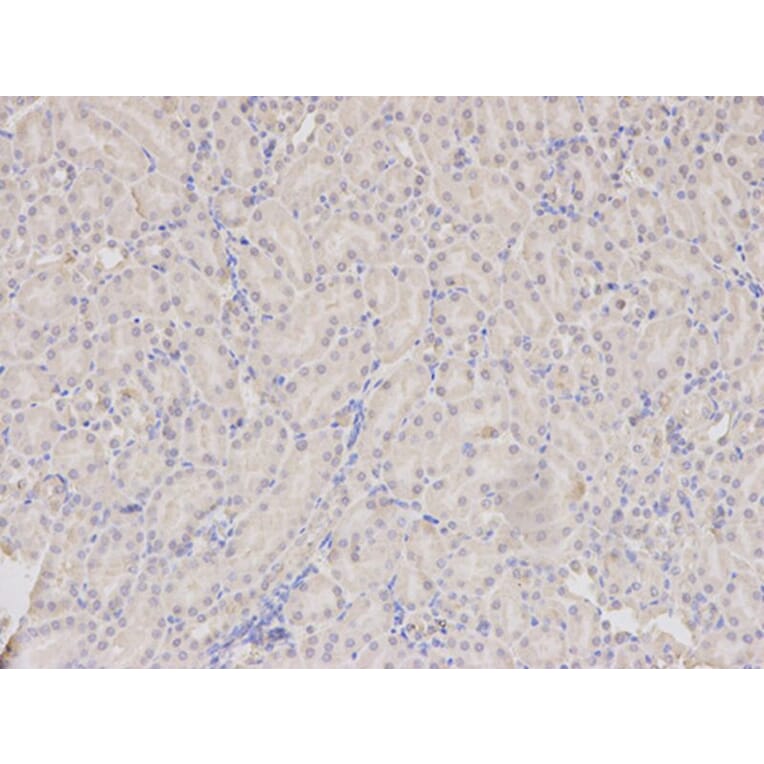 Immunohistochemistry - TLR3 Antibody from Signalway Antibody (32281) - Antibodies.com