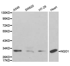 Western blot - NQO1 Antibody from Signalway Antibody (32295) - Antibodies.com