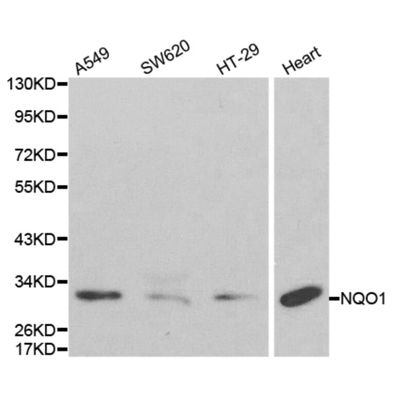 Western blot - NQO1 Antibody from Signalway Antibody (32295) - Antibodies.com