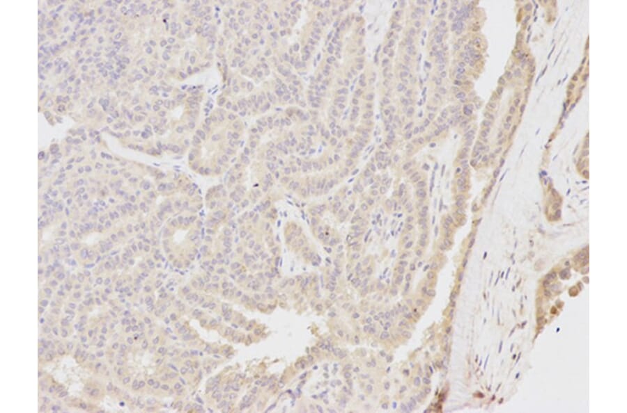 Immunohistochemistry - NQO1 Antibody from Signalway Antibody (32295) - Antibodies.com