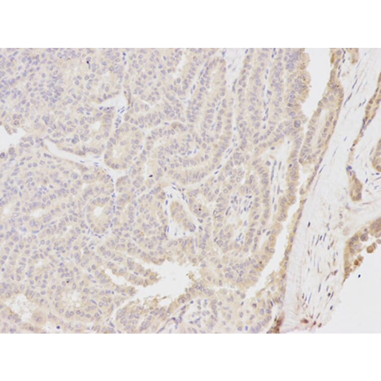 Immunohistochemistry - NQO1 Antibody from Signalway Antibody (32295) - Antibodies.com