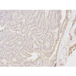 Immunohistochemistry - NQO1 Antibody from Signalway Antibody (32295) - Antibodies.com