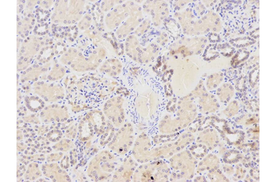 Immunohistochemistry - NQO1 Antibody from Signalway Antibody (32295) - Antibodies.com