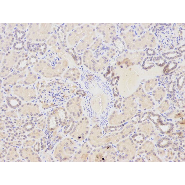 Immunohistochemistry - NQO1 Antibody from Signalway Antibody (32295) - Antibodies.com