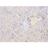 Immunohistochemistry - NQO1 Antibody from Signalway Antibody (32295) - Antibodies.com