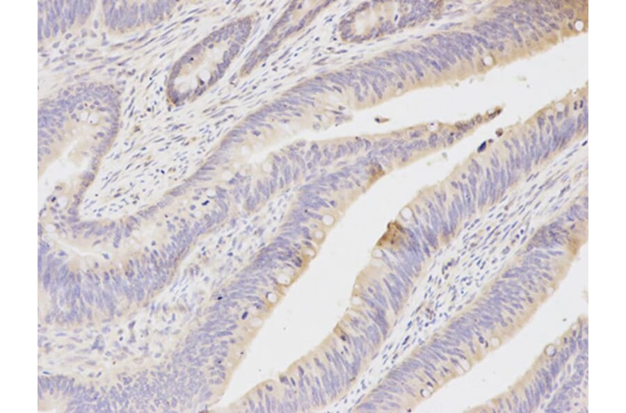 Immunohistochemistry - NQO1 Antibody from Signalway Antibody (32295) - Antibodies.com