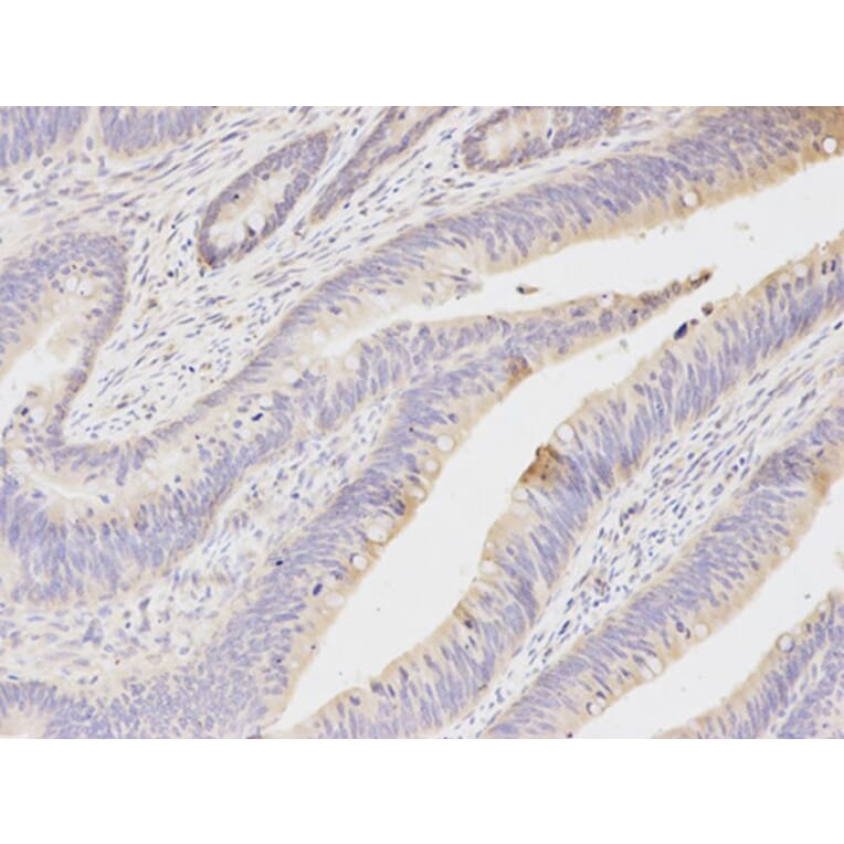 Immunohistochemistry - NQO1 Antibody from Signalway Antibody (32295) - Antibodies.com