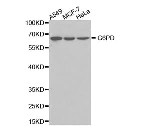 Western blot - G6PD Antibody from Signalway Antibody (32301) - Antibodies.com