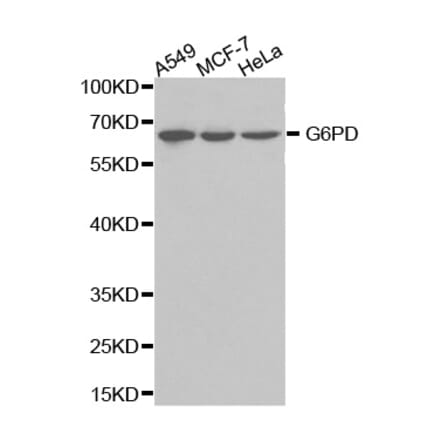 Western blot - G6PD Antibody from Signalway Antibody (32301) - Antibodies.com