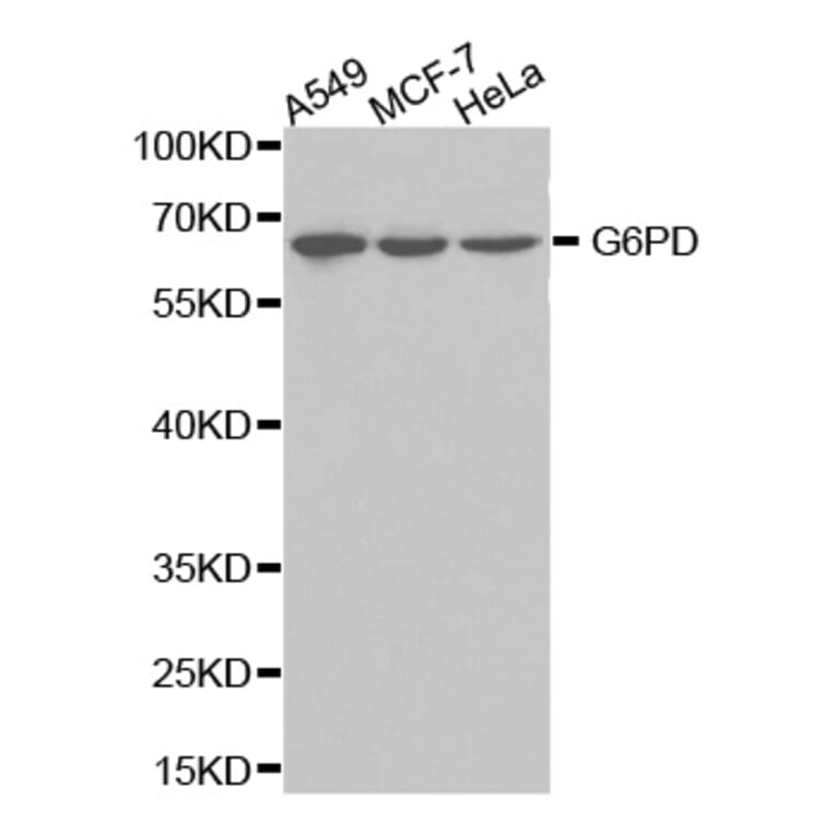 Western blot - G6PD Antibody from Signalway Antibody (32301) - Antibodies.com