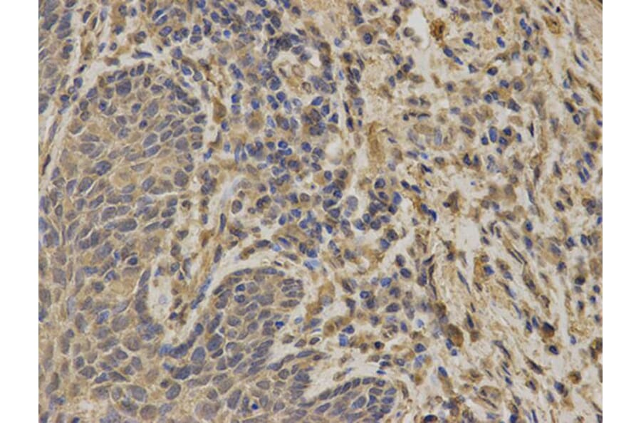 Immunohistochemistry - G6PD Antibody from Signalway Antibody (32301) - Antibodies.com