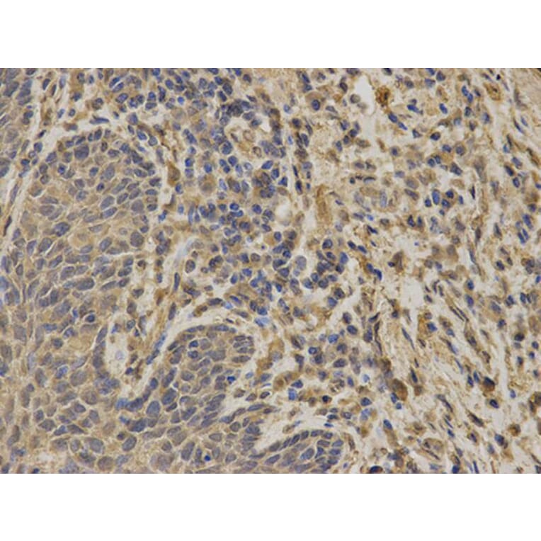 Immunohistochemistry - G6PD Antibody from Signalway Antibody (32301) - Antibodies.com