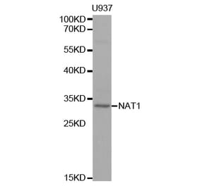 Western blot - NAT1 Antibody from Signalway Antibody (32310) - Antibodies.com