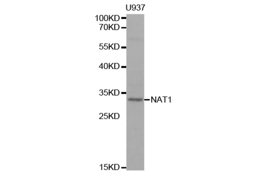 Western blot - NAT1 Antibody from Signalway Antibody (32310) - Antibodies.com