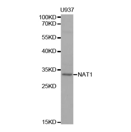 Western blot - NAT1 Antibody from Signalway Antibody (32310) - Antibodies.com