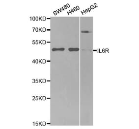 Western blot - IL6R Antibody from Signalway Antibody (32315) - Antibodies.com